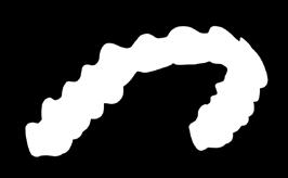 fi/kurssit Avain menestykseen Invisalignilla! itero + Invisalign.