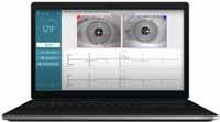 Micromedical by Interacoustics Tasapaino VisualEyes 505 Video Frenzel VisualEyes 505 on erilainen Video Frenzel -järjestelmä kuin useimmat.