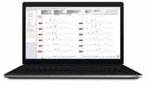 ABR/OAE EP15 Diagnostiikka ABR EP15 tarjoaa perinteiset ABR-mittaukset kuulokynnyksen ja neurologisten toimintojen testaamiseen.