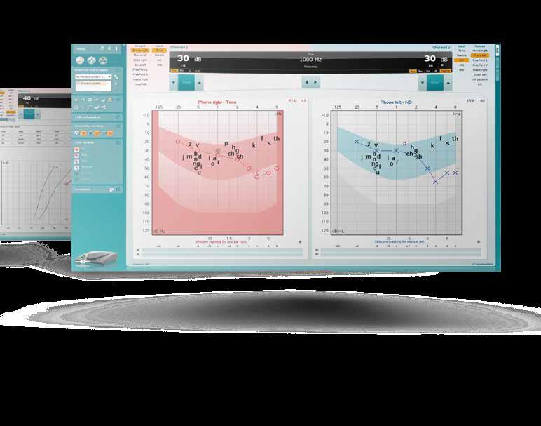 Hearing Aid Fitting Affinity Compact, Affinity 2.0 & Callisto Affinity Compact, Affinity 2.