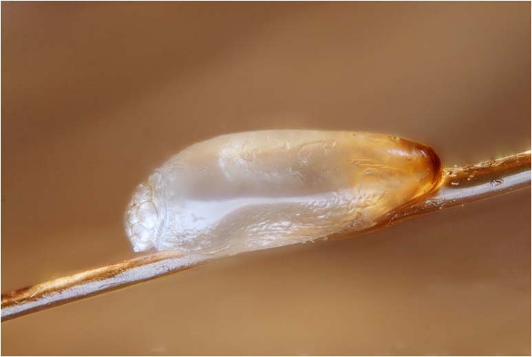Täitartunnan toteaminen, saivareet Saivareet, täin helmenharmaat munat, ovat tiukasti kiinni hiuksen tyvessä. Saivareet ovat kooltaan noin 1 mm:n pituisia.