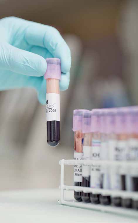 Yliopistosairaaloiden laboratorioissa on valmiudet tunnistaa potilaalla esiintyvä genotyyppi tavallisesta verinäytteestä.