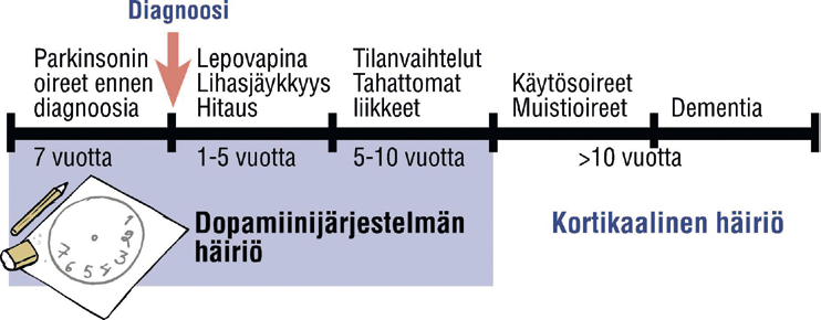 kaikista muistisairauksista noin 3 4 %. Muistisairaus havaitaan keskimäärin 10 vuoden kuluttua Parkinsonin taudin oireiden alkamisesta, mutta yksilöllinen vaihtelu on huomattavaa.