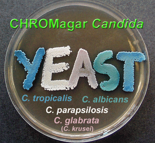 6 Sienet ja terveys 1 / 2010 Koska Aspergillus-infektioiden yleisyydestä ei ole kunnollista kansallista tai kansainvälistä tietoa, niin täytyy tyytyä kirjoittajan omaan tuntumaan: täällä Pohjolan