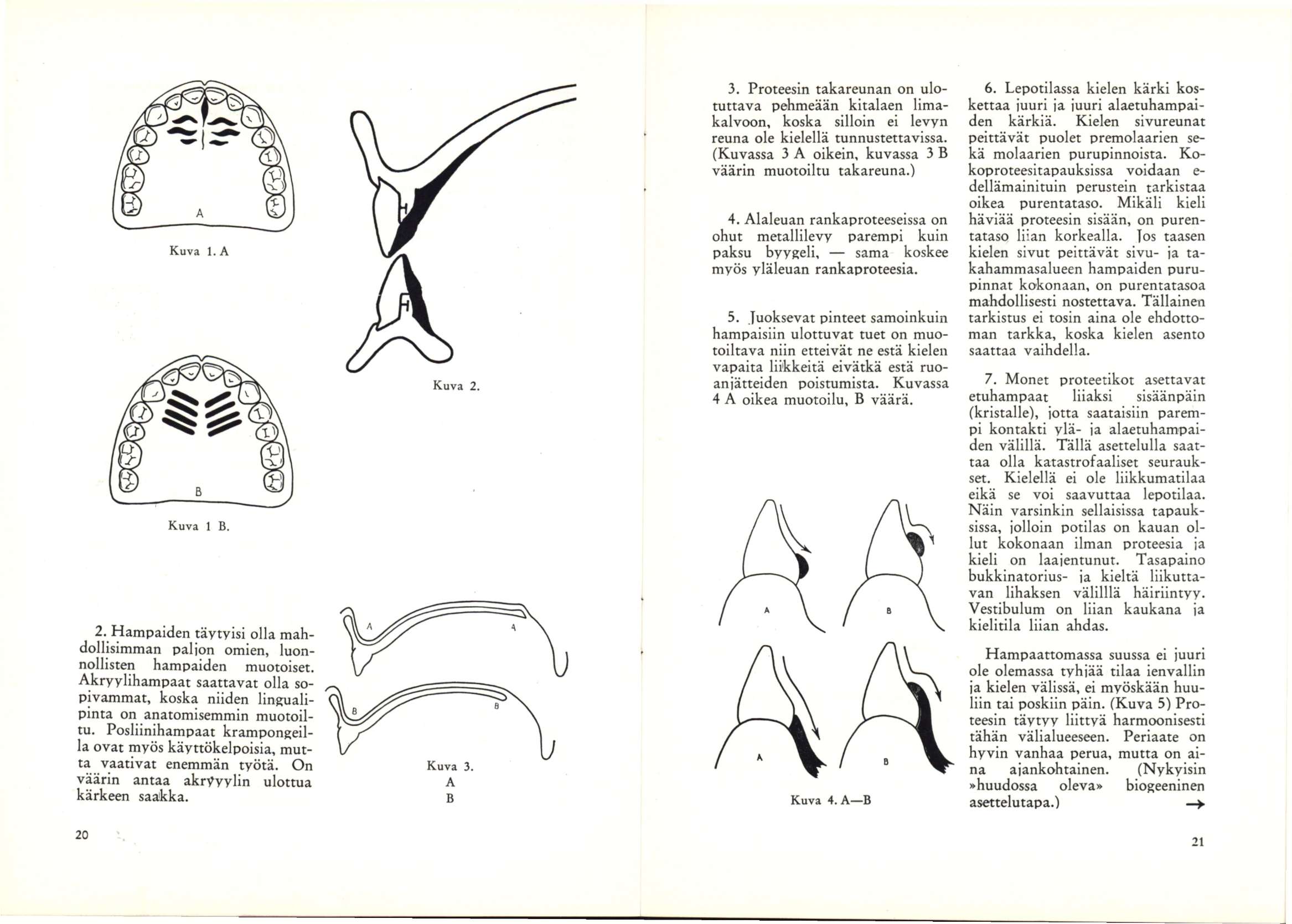 Kuva l.a Kuva 1 B. 2. Hampaiden täytyisi oiia mahdoiiisimman paijon omien, iuonnoiiisten hampaiden muotoiset.