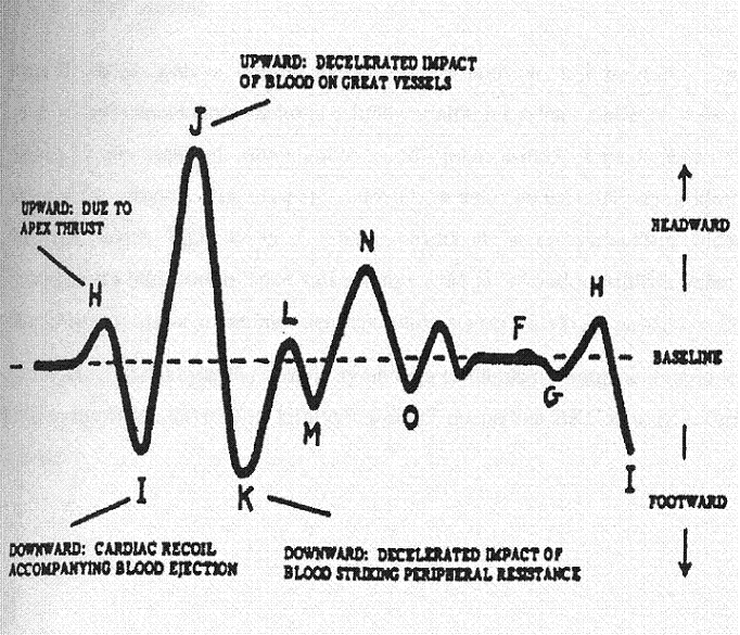 10 Kuva 8: BKG-signaalin nimetyt huiput G-O ja niihin liittyvät tapahtumat sydämen toimintakierrossa. Kuvan BKG-signaali on mitattu HF-systeemillä (high-frequency).