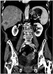 If you are or think you might be pregnant, please inform the radiological staff before the