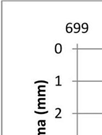 siirtymäantureilla mitatut m