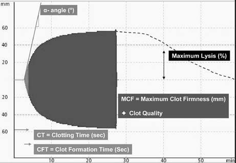 data processing unit tact activator) ja ulkoisen hyytymisjärjestelmän (EXTEM, Tissue factor) aktivaattoreita sekä trombosyyttien osuuden poistavaa laukaisuainetta (FIBTEM, Tissue factor +