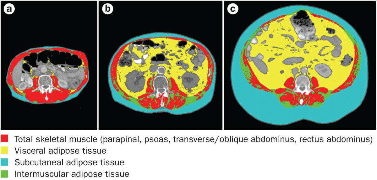 (2012) Understanding the mechanisms and treatment options in