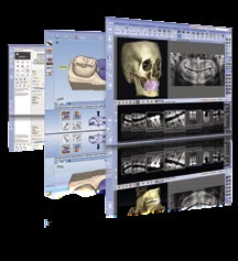 Uutuuksia Planmeca tuo alansa ensimmäisenä röntgenkuvantamisen, CAD/CAM-työskentelyn ja hammashoitokoneet samaan ohjelmistoon VERKKO Planmeca Romexis on maailman ensimmäinen hammasalan ohjelmisto,