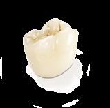 Planmeca PlanCAD Premium -ohjelmistolla onnistuu kaikkien proteettisten töiden suunnittelu yhden hampaan yksiköistä koko leuan kattaviin rakenteisiin.