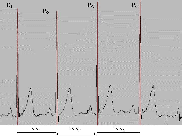 18 EKG-käyrässä QRS-kompleksiin kuuluvat R-piikit muodostuvat siis sydämen kammioiden supistuessa. Peräkkäisten R-piikkien väliä kutsutaan sykeväliksi (RR-väli).