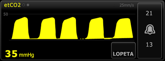 Käyttöohjeet Potilaan monitorointi 97 etco2-numeronäkymä Numeronäkymä näyttää kertahengityksen lopun CO2:n (etco2) ja sisäänhengitetyn CO2:n fraktion (FiCO2) mmhg:nä tai kpa:na.