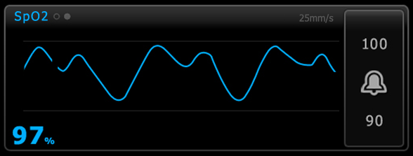 134 Potilaan monitorointi Welch Allyn Connex Vital Signs Monitor 6000 Series SpO2-käyränäkymä Käyränäkymä näyttää reaaliaikaisen SpO2-pletysmografikäyrän.