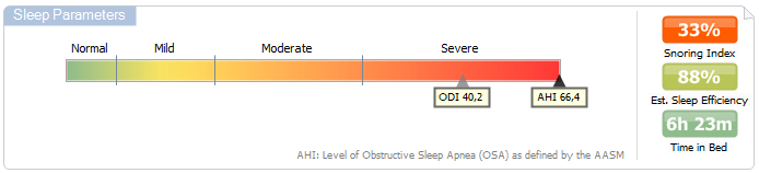 Option (asetukset)-> Automation (automaattiset) -> Reports (raportit) ja määrittämällä asetukset.