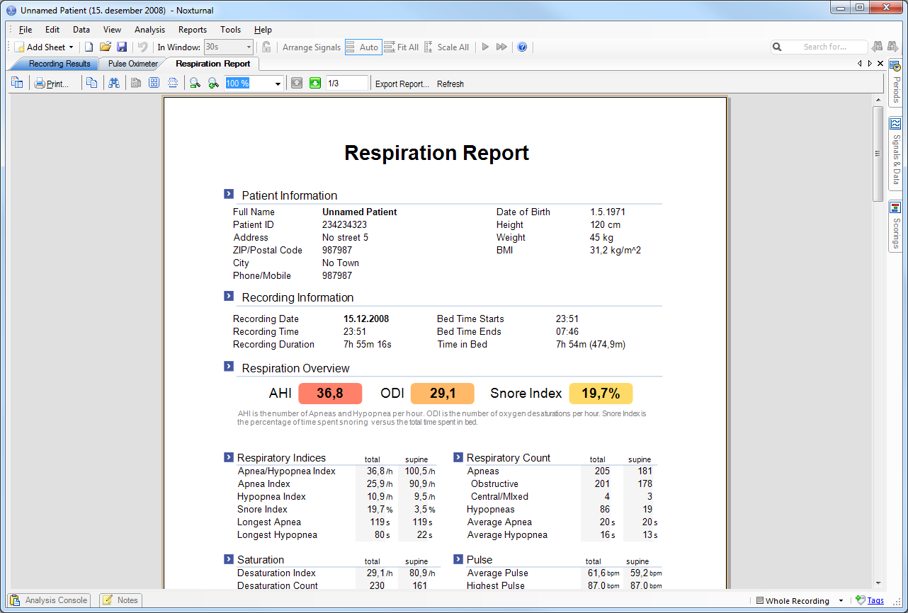 Hengitysraportti (Respiration Report) Hengitysraportissa on yhteenveto unihäiriöön liittyvistä hengitysparametreista, kuten apneahypopneaindeksistä (AHI).