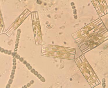 Mikrolevät Monimuotoinen ryhmä mikroskooppisia organismeja Sekä