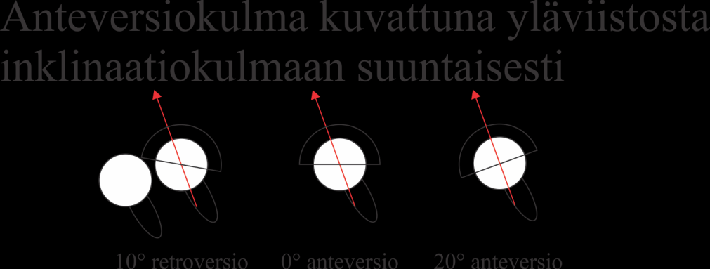 kuvaa arvioitua kuormitussuuntaa. Ympyrä kuvaa nuppia ja ympyrästä lähtevä ellipsi kuvaa reisikomponenttia.