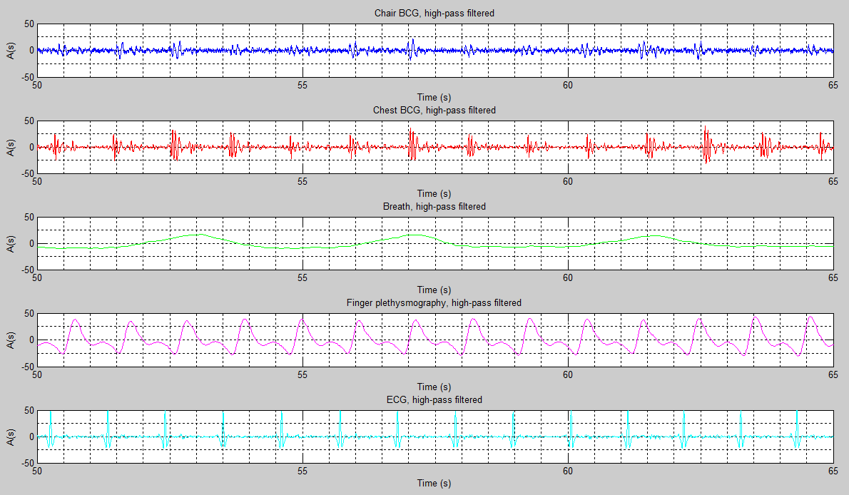 Kuva 20. Koehenkilön 10 signaalit muokkaamattomina.