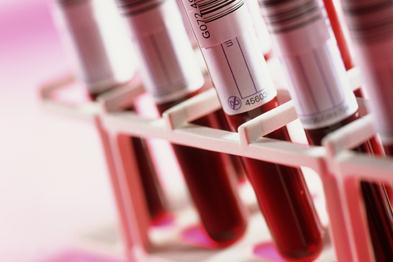 Metabolomic profiling (UPLC-MS)