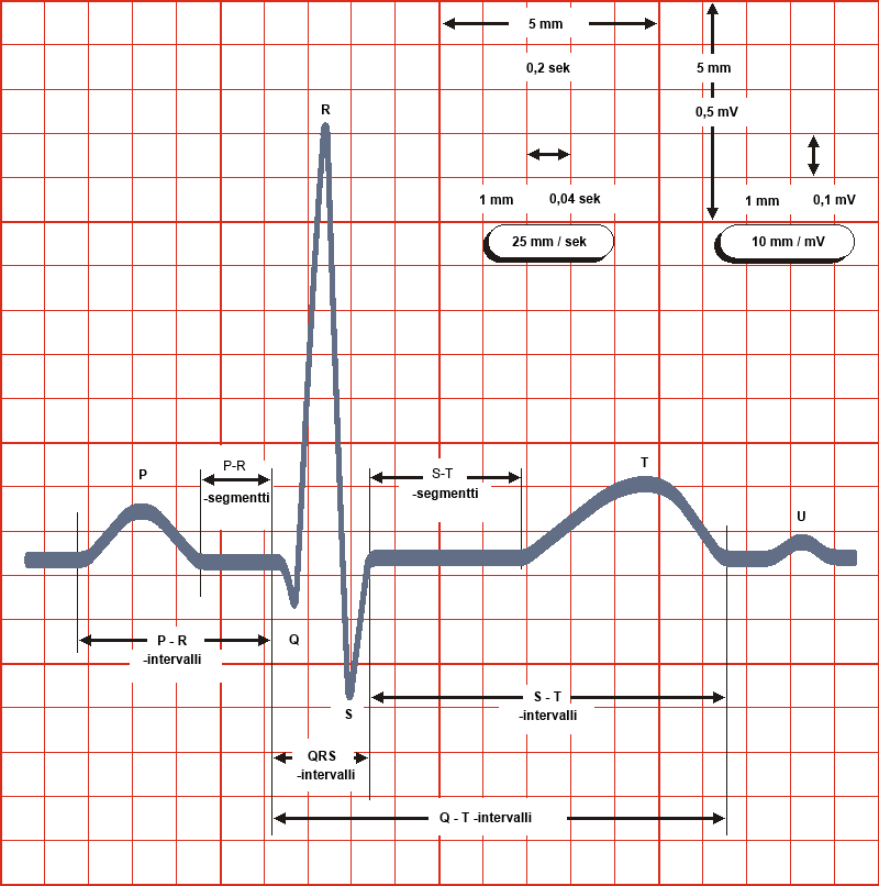 24 sieltä pitkin kammioiden lihassolukkoa ja ulkoseinämiä kohti eteisiä, joka saa kammiot supistumaan. Vaihetta kutsutaan QRS-intervalliksi.