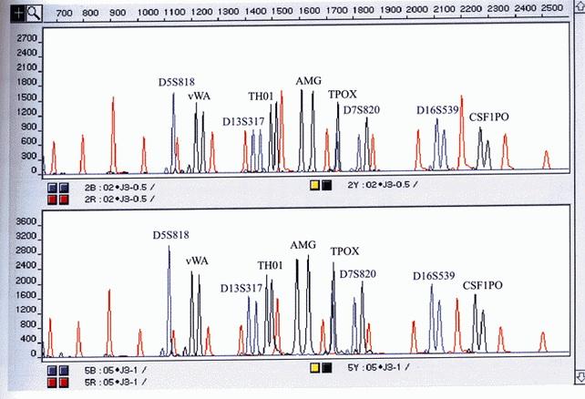 Tulokset esitetään käyränä, yksilön DNAtunnisteena, joka vastaa yksilön geneettistä perimää. DNA-tutkimus alkaa näytteiden taltioimisesta.