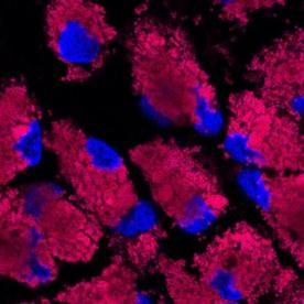 Biomassan uutos- ja esitestausmenetelmien ja erilaisten in vitro-solumallien avulla pyritään löytämään yhdisteitä ja/tai uutoksia, joilla voisi olla bioteknisiä tai farmakologisia