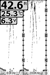 Jaettu zoomaustila(200/83khz) Manuaalinen zoomaus Kun "Syvyysalue" asetetaan manuaalisesti, paina Zoom painiketta.