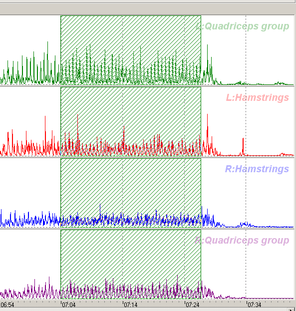 Lapsipotilas (CP)