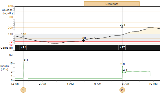 Glukoosi, hiilihydraatit ja insuliini Tämä kaavio sisältää potilaan glukoosiarvot, nautitut hiilihydraattimäärät ja insuliinin käytön valitun vuorokauden ajalta.