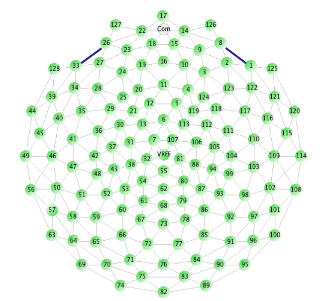 3. EEG-signaalin analysointi 10 missä A on kaikkien elektrodien aktiivisuus. Lopuksi referenssikanavan aktiivisuus lisätään kaikkiin kanaviin. E ref x = Ex + Cz (3.