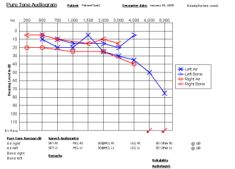 kyyhkyt Audiogrammi (ihmisen) 0 db =0,0002 mikrobaaria Tasapaino- ja liikeaisti Tasapaino- ja liikeaistin aistinsolut vestibulaarielimessä