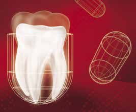Clearfil Universal Bond Yleissidosaine kaikkiin hammashoidon tekniikoihin Clearfil Universal Bond on yksikomponenttinen, valokovetteinen sidosaine suoriin ja epäsuoriin paikkauksiin kaikkien