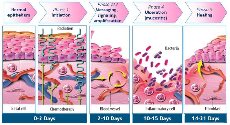 10 päivän kuluttua Sädehoito pään alueelle: 30 Gy:n annoskertymän jälkeen (3-10 päivää) Erythema eli punoitus Ulseraatiot eli haavaumat Pseudomembraani