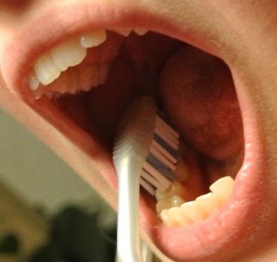 OMAHOITO Harjaa hampaat Hampaiden harjaus on tärkeintä suun omahoidon kannalta.