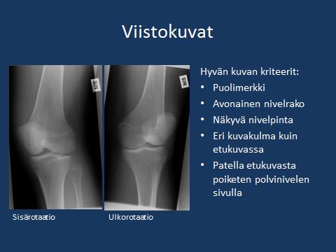 Traumapolven