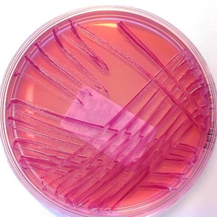 11 (29) Verrattuna salmonellaan, shigelloilla on suurempi taipumus tunkeutua suolen seinämään aiheuttaen shigelloosia. Shigellojen esiintyminen veressä on hyvin harvinaista.