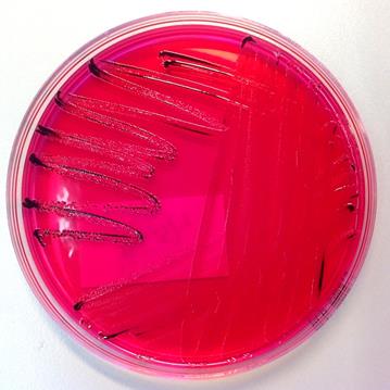 9 (29) Salmonellabakteerit säilyvät ulosteessa ja bakteereita erittyy ripulin aikaan ulosteeseen runsaasti. Tämän vuoksi salmonella useimmiten diagnosoidaan ulosteesta tehtävällä bakteeriviljelyllä.