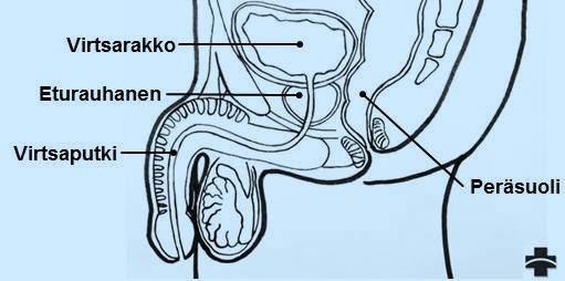 Tällöin loppuelämä ei välttämättä lyhene tai edes laadullisesti merkittävästi huonone. Haluamme antaa tietoa sairaudestasi, jotta selviytyisit mahdollisimman hyvin kotioloissa.