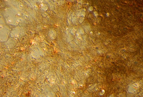 Kuva 6. Osteoblastit värjättynä Von Kossa menetelmällä. Luunoduleiden kalsium on korvattu hopealla, joka näkyy ruskeana värjäytymisenä kuoppalevyllä.