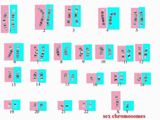 Kromosomien määrä voi olla haploidi (n; esim. ihmisellä sukusoluissa 23 kromosomia) tai diploidi (2n; ihmisellä hedelmöittyneessä munasolussa eli tsygootissa 2 x 23 = 46 kromosomia).