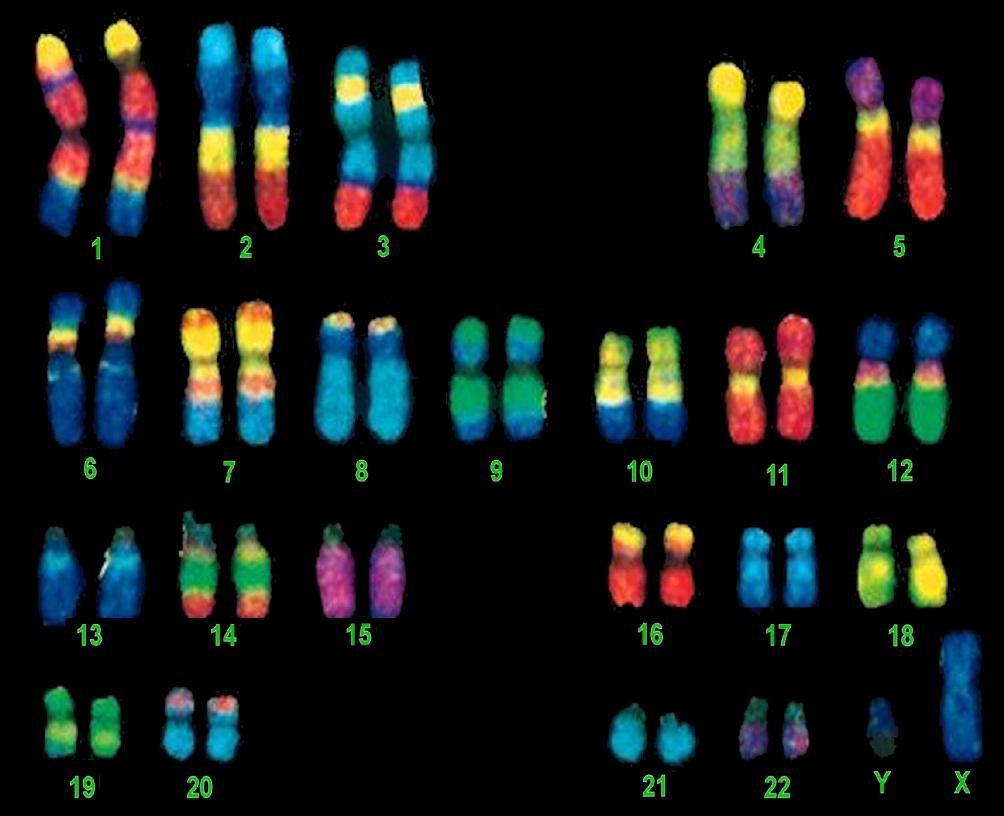 DNA ja kromosomi - Jakautuvan solun DNA on kiertynyt spiraaleiksi useaan kertaan proteiinipallojen (histonit) ympärille.