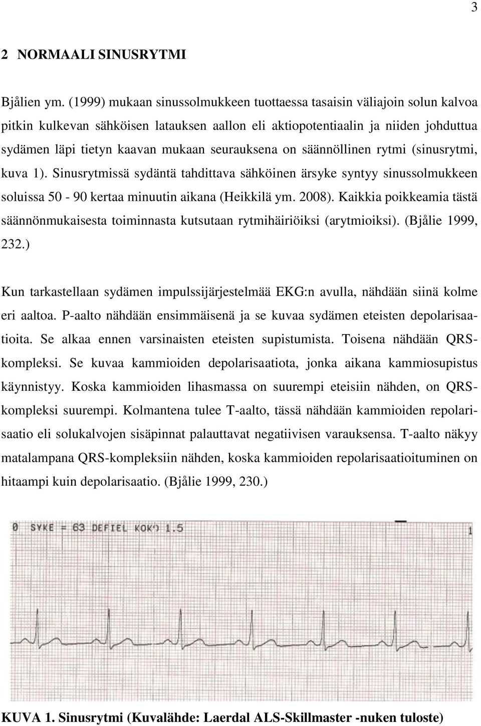 seurauksena on säännöllinen rytmi (sinusrytmi, kuva 1). Sinusrytmissä sydäntä tahdittava sähköinen ärsyke syntyy sinussolmukkeen soluissa 50-90 kertaa minuutin aikana (Heikkilä ym. 2008).