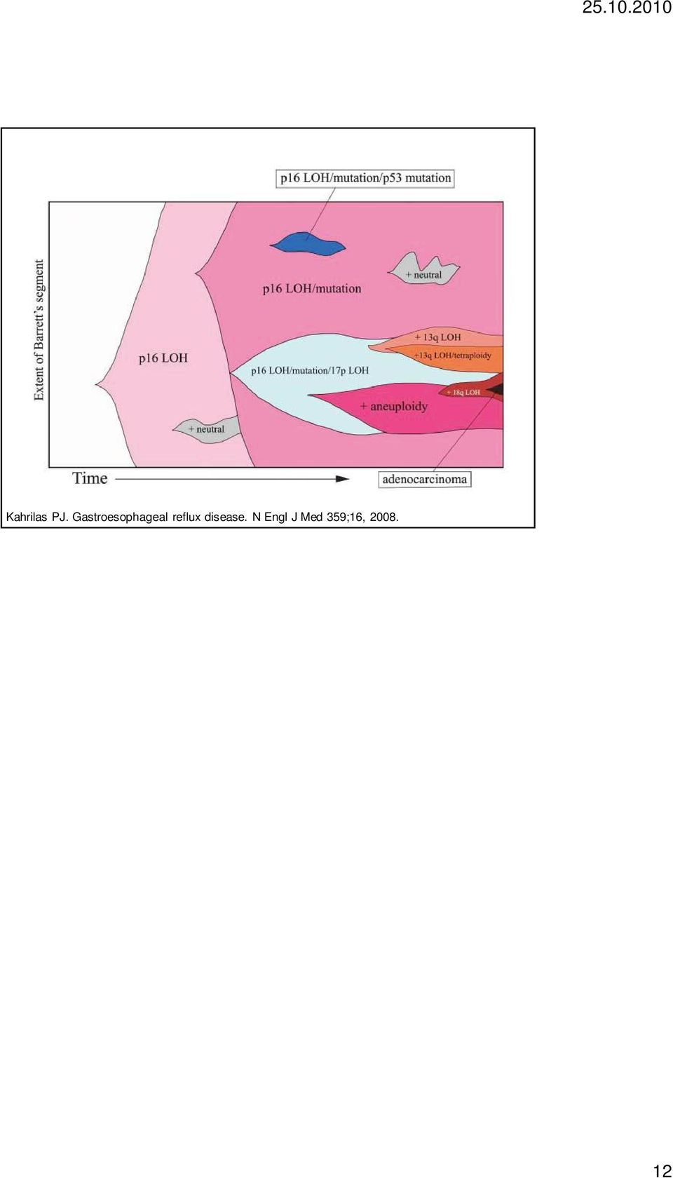 reflux disease.