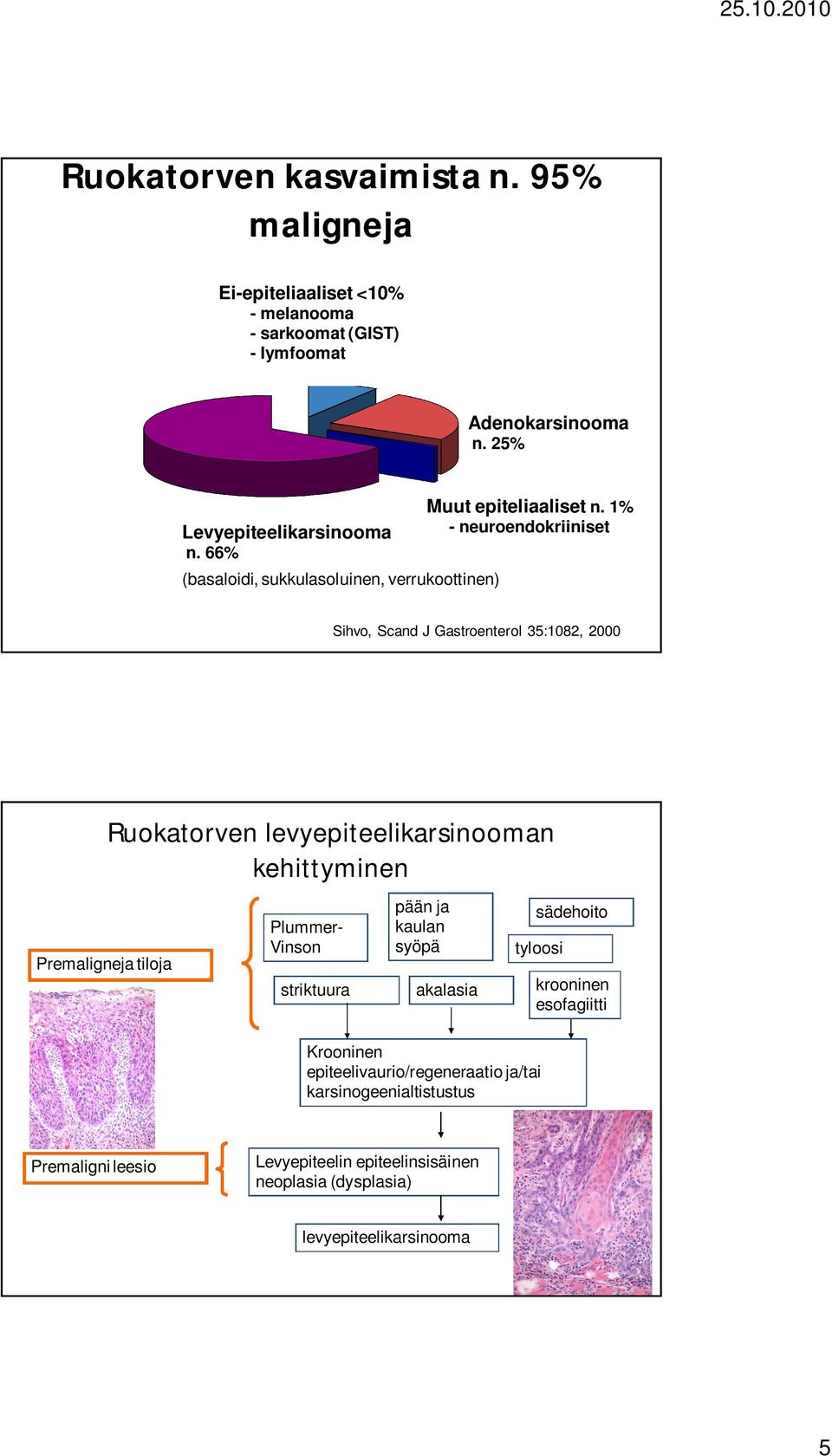 1% - neuroendokriiniset Sihvo, Scand J Gastroenterol 35:1082, 2000 Ruokatorven levyepiteelikarsinooman kehittyminen Premaligneja tiloja Plummer- Vinson