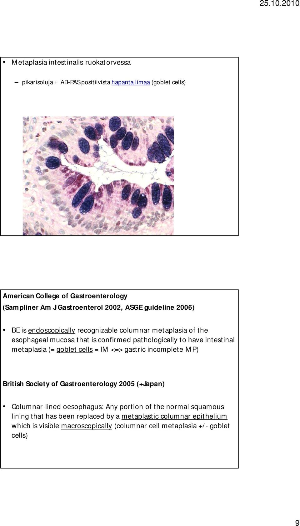 !! (Dg = endoskopia + histologia) Sic lievä basaalinen atypia kuuluu metaplasiaan Pseudogoblet - AB-PAS heikko/negatiivisia gobletteja Voimakkaasti AB-PAS positiivisia hapanta limaa sisältäviä