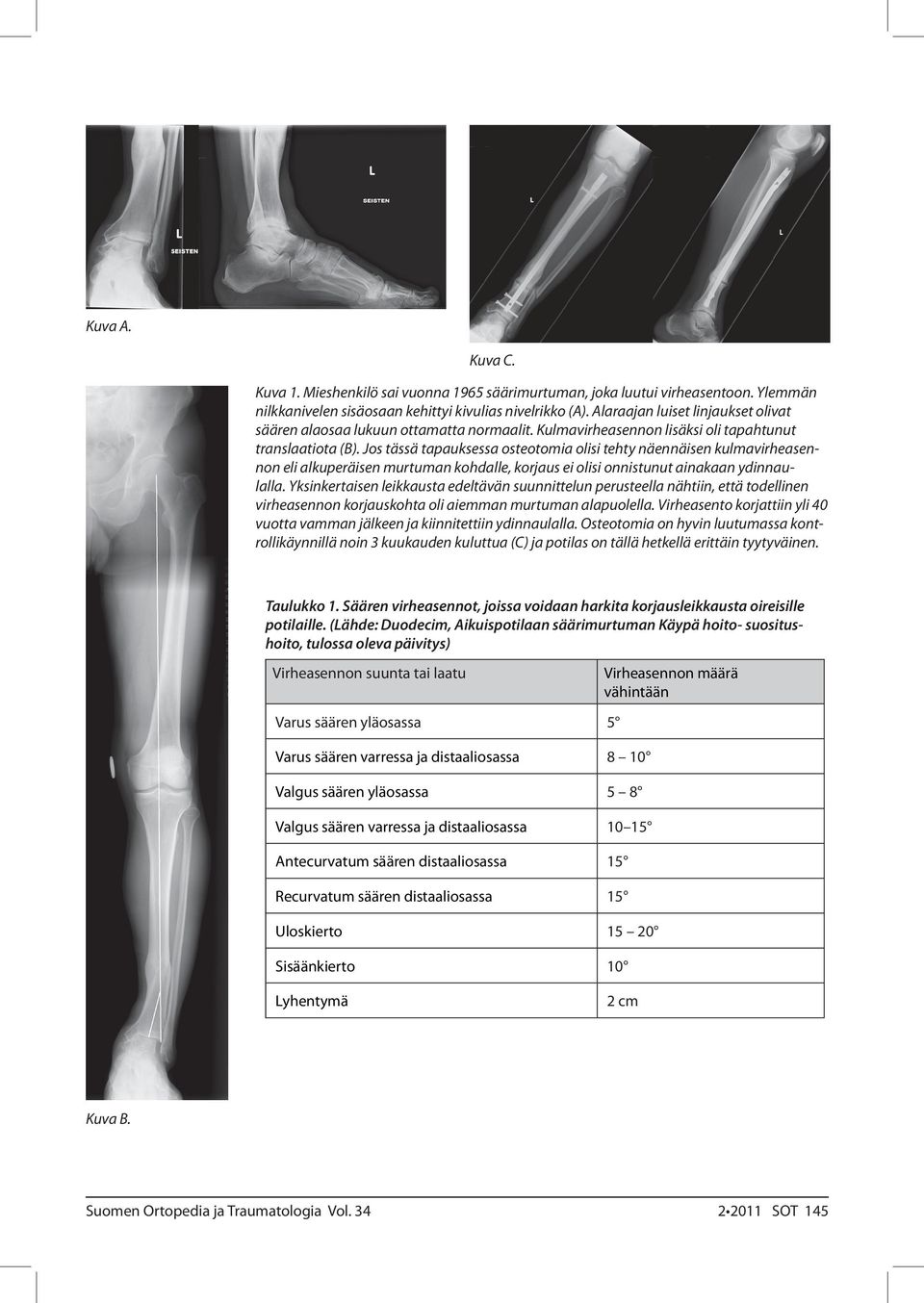 Jos tässä tapauksessa osteotomia olisi tehty näennäisen kulmavirheasennon eli alkuperäisen murtuman kohdalle, korjaus ei olisi onnistunut ainakaan ydinnaulalla.