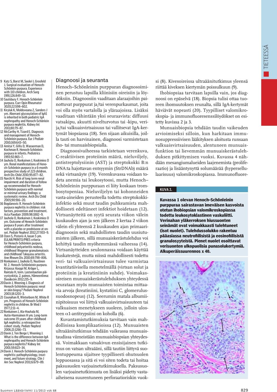 Kidney Int 2011;80:79 87. 12 McCarthy H, Tizard E. Diagnosis and management of Henoch- Schönlein purpura. Eur J Pediatr 2010;169:643 50. 13 Amitai Y, Gillis D, Wasserman D, Kochman R.