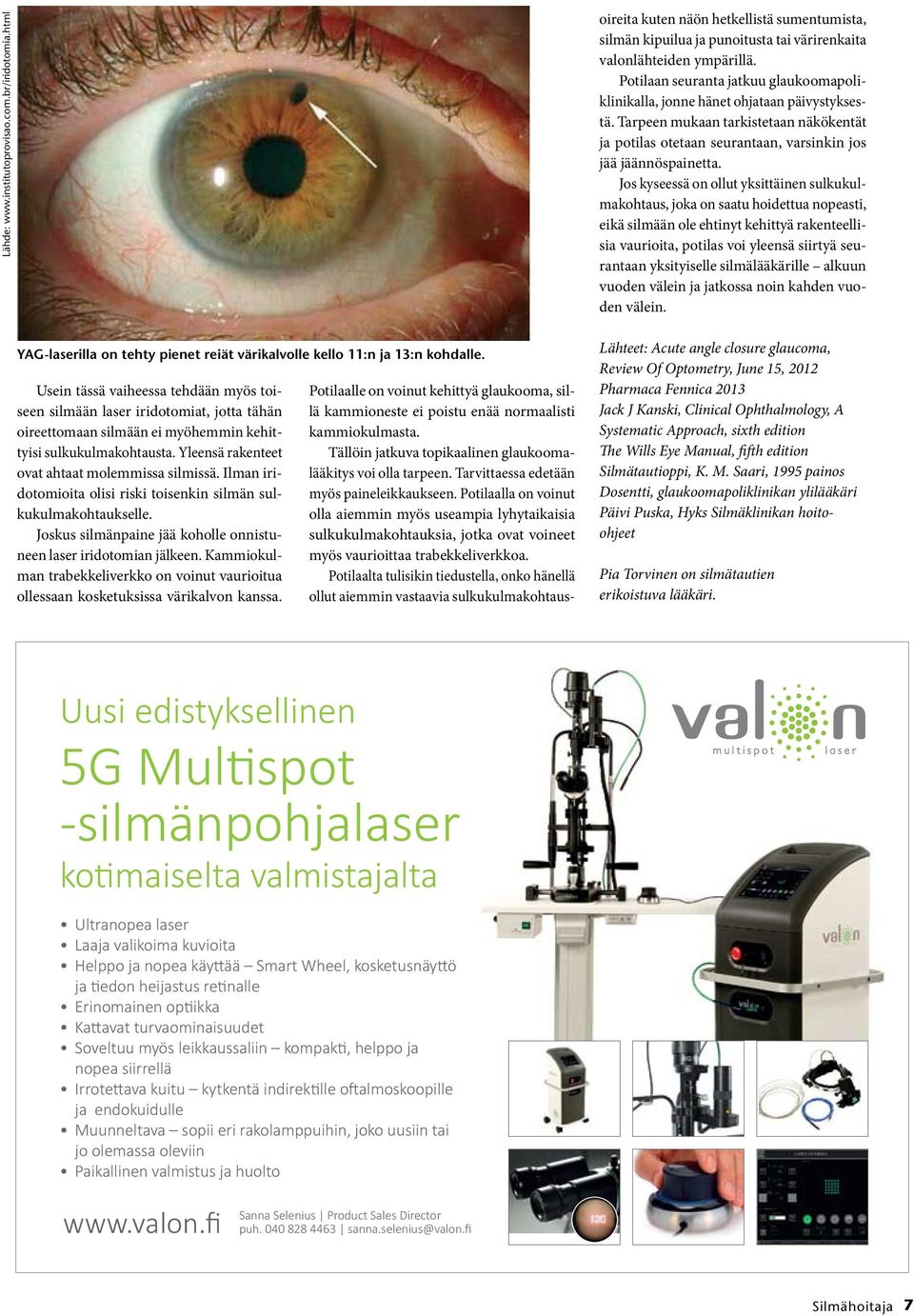 Ilman iridotomioita olisi riski toisenkin silmän sulkukulmakohtaukselle. Joskus silmänpaine jää koholle onnistuneen laser iridotomian jälkeen.